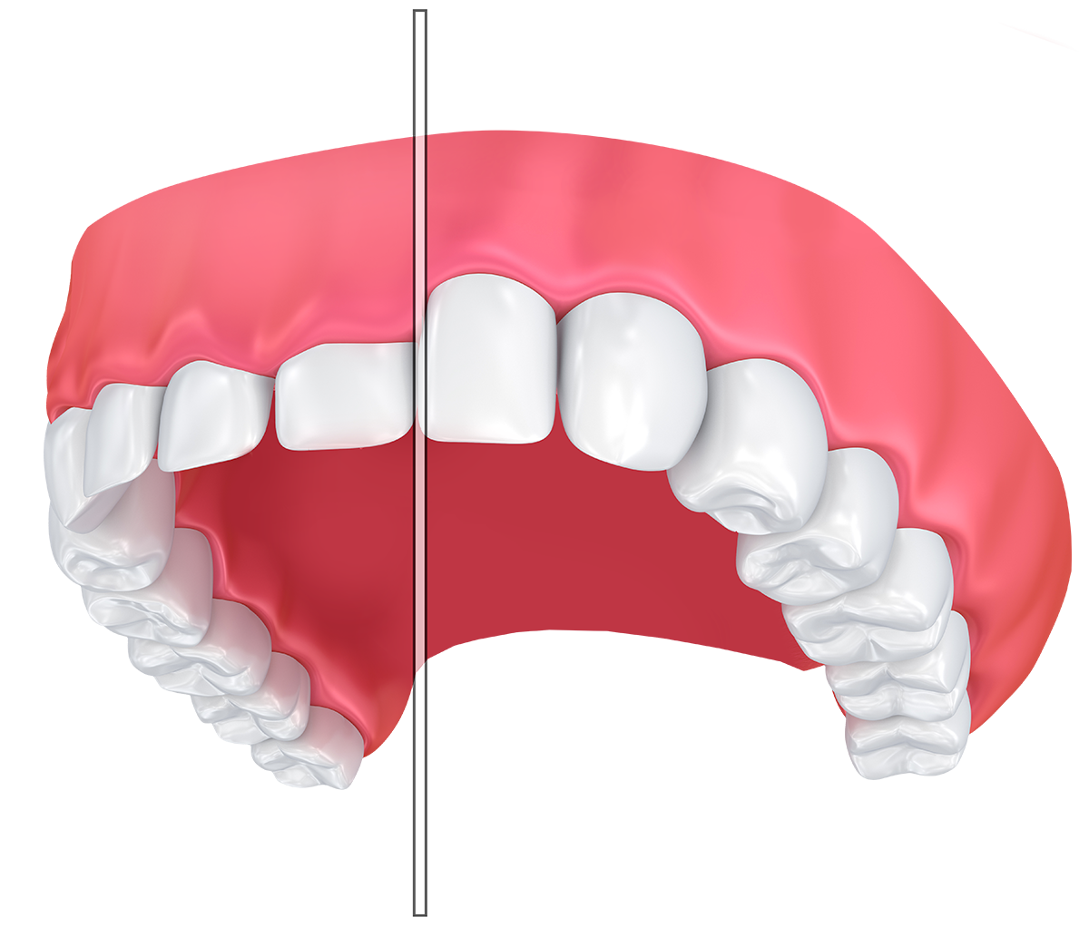 Contouring and Reshaping